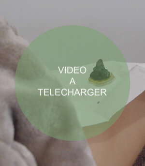 soins naturels Vidéo payante n°1 Élimination du froid avec ventouse et moxibustion